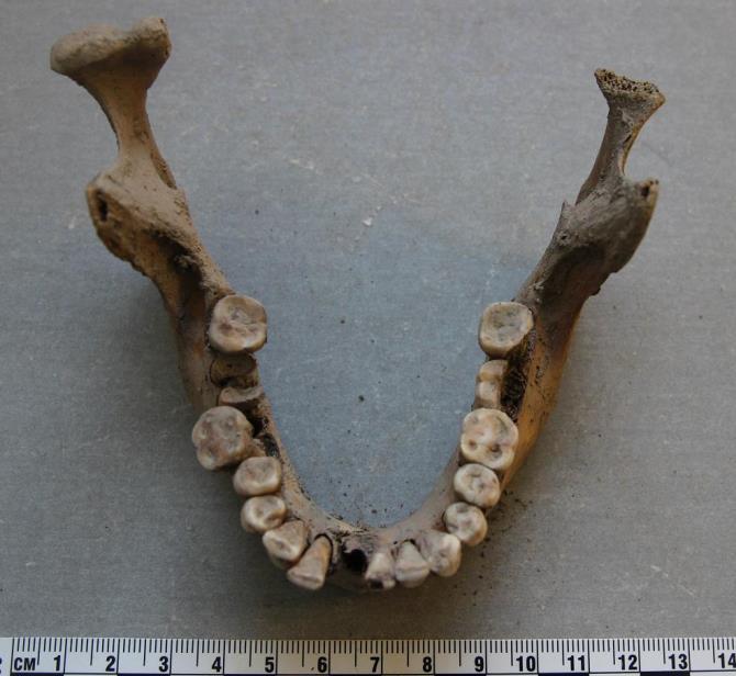 Hauta 21. Iänmääritys: adultus/maturus Sukupuolen arviointi: nainen Pituusarvio: n. 145 cm Patologiat/poikkeavuudet: vainajan alaleuan hampaissa on hammasmätää ja hammaskiveä.