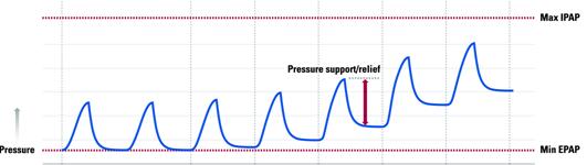 Sentraalisen apnea, Cheyne-Stokeshengityksen hoitoon Tavallisimmat hengityslaitehoidon tyypit CPAP (Continuous positive airway pressure) Automaattinen CPAP (APAP, Automatic positive airway pressure)