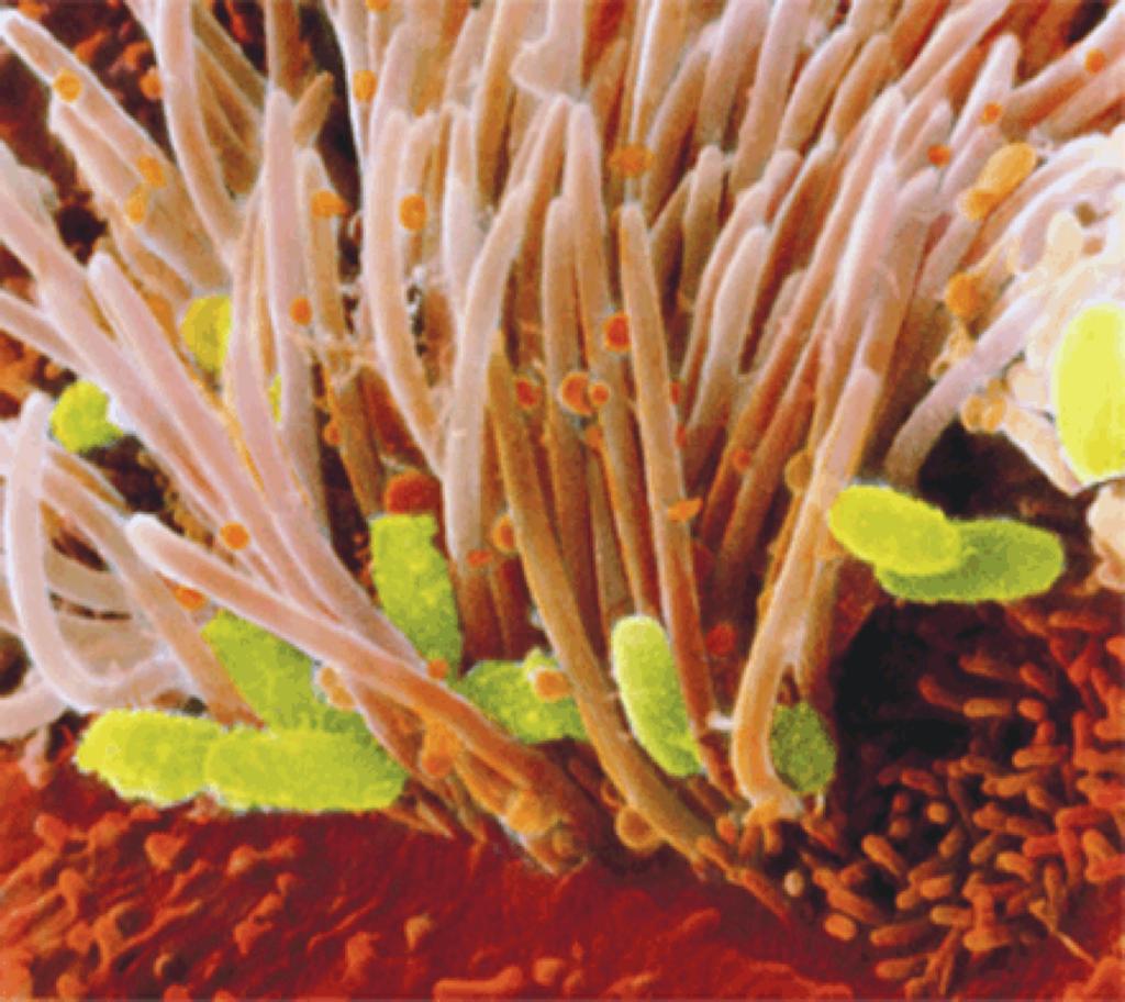 The Pertussis Paradox Science, August 2, 2013 The introduction of a safer vaccine has