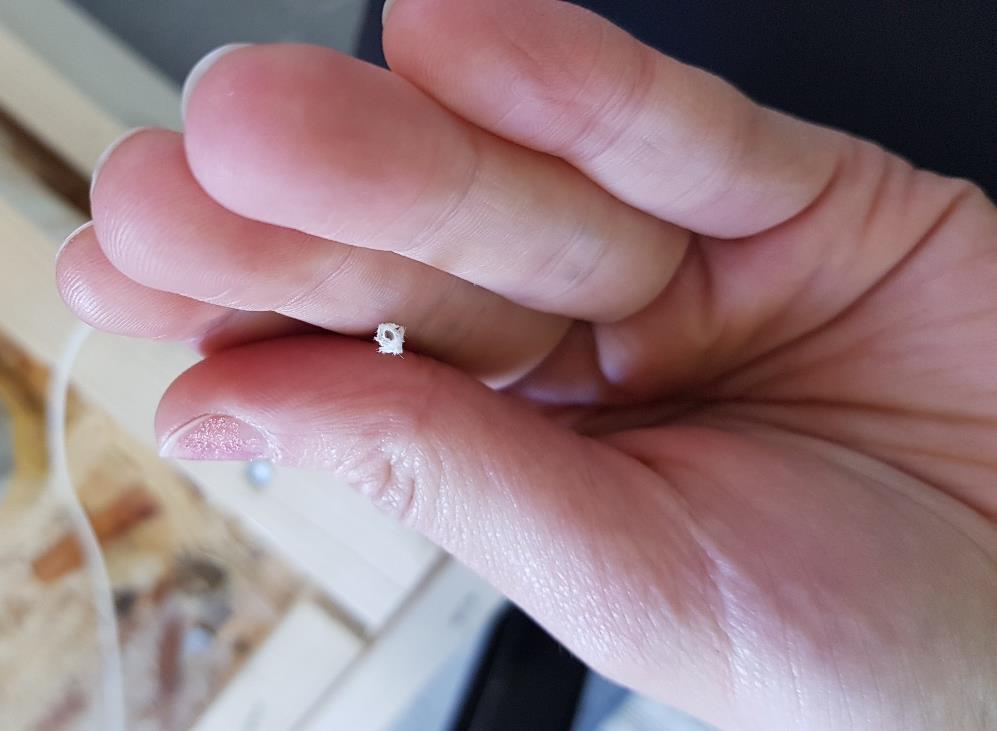 46 käyttää tehokasta natriumhypokloriittia. ZeeWeed 500D onttokuitukalvon ulkohalkaisija on 1,9 mm ja sisähalkaisija 0,8 mm. Kuidun onttoa sisustaa, jossa permeaatti virtaa, kutsutaan nimellä lumen.