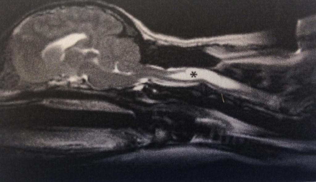 8 Kuva 1. Esimerkkikuva cavalier kingcharlesinspanielin päänalueen ja selkäydinkanavan magneettikuvasta.