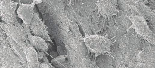 OsteoBiol -biomateriaalit jatkuvaa aktiivista tutkimus- ja kehitystyötä SEM image of an OsteoBiol Gen-Os granule colonised by osteoblasts from a cell-line (MG63).
