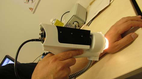 Ihosyöpä Ensimmäinen prototyyppi ollut kliinisessä koekäytössä Päijät-Hämeen keskussairaalan ihotautiosastolla 2013 2014 Yli 100