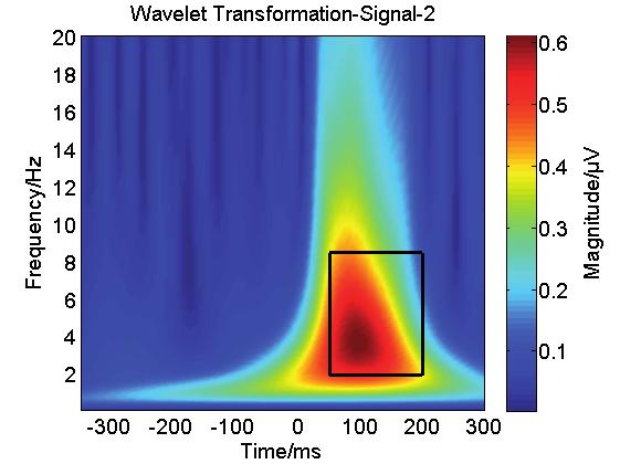 22 time-frequency points within the ROI. Therefore, such a parameter can spontaneously reflect the temporal and spectral information of MMN.