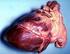 Synnynnäisiin sydänvikoihin liittyvät rytmihäiriöt