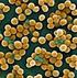 MRSA(Metisilliiniresistentti Staphylococcus aureus)- KANTAJA PITKÄAIKAISHOIDON YKSIKÖSSÄ