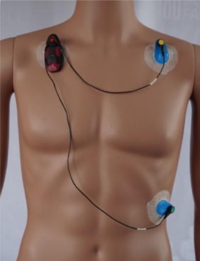 Holter-EKG / Sydämen pitkäaikaisrekisteröinti Faros-sydänsensori on erittäin potilasystävällinen, pieni ihonpäällinen EKG mittalaite, jolla voi tehdä jopa seitsemän päivän kestoisia Holter-mittauksia.