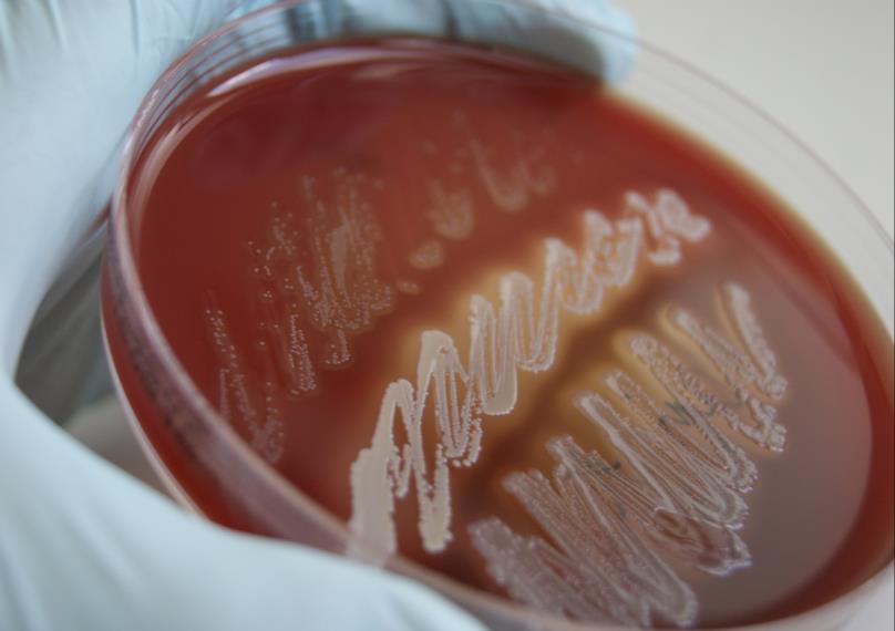 Pikatestit ovat usein immunologisia testausmenetelmiä, jotka perustuvat antigeenin tai vasta-aineiden osoitukseen näytteestä.
