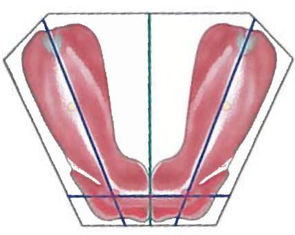 20 Hampaattomassa leuassa kulmahampaiden paikat ovat alveoliharjanteen kulmissa. Ensimmäisten molaarien paikat näkyvät painaumina taka-alueen alveoliharjanteessa. (Hohmann & Hielscher 2016, 264.