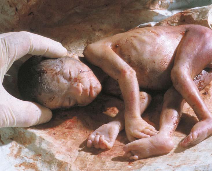 Tässä me näemme samankaltaisuuden nykyiseen aborttitilanteeseen. Aborttilääkäri ei vihaa sikiötä. On vain kerta kaikkiaan niin, että sikiöltä puuttuu kokonaan ihmisarvo.