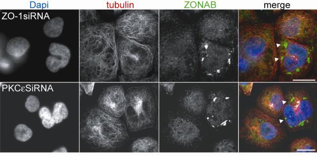 between tight junctions and the nucleus (Balda, Garrett & Matter 2003).