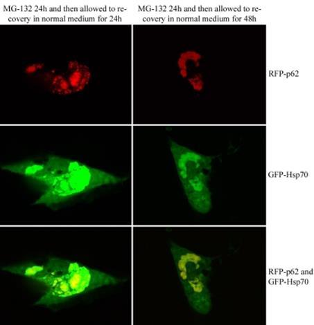 p62/sequestome-1 p62 akkumuloituu perinukleaarisiin lysosomijäänteisiin, kun proteasomaalinen hajoitus estetään (Viiri et al. Mol Vis.