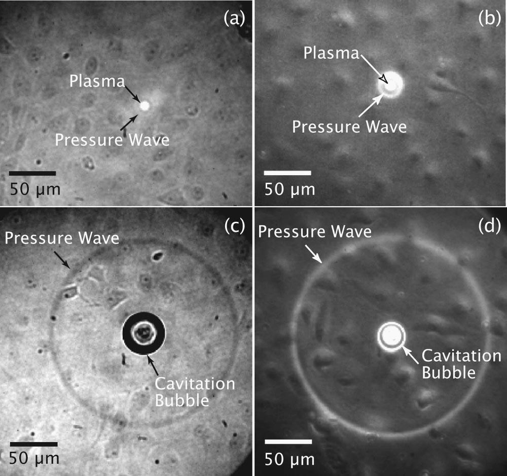 49 Kuva 20. Plasman ja kavitaatio kuplan muodostus soluviljelmässä käytettäessä pulssilaseria. A ja b kuvat 10 ns laserpulssin jälkeen ja c ja d kuvat 67 ns laserpulssin jälkeen (Rau et al., 2004). 5.
