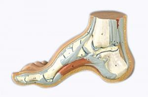 26 Kuva 9. Kaarijalka (MedicMD) Joustava kaarijalka tarvitsee lujat, asentoa tukevat kengät, kun taas puolestaan jäykkä kaarijalka tarvitsee kiertolöysemmät ja iskunvaimennuskykyiset kengät.
