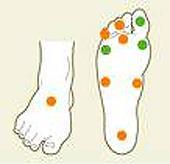 32 Aikaisempi jalkahaava Aikaisempi verisuonitoimenpide Näköä uhkaava retinopatia Nefropatia Huono veren sokeritasapaino Tupakointi Virheellinen tai puutteellinen jalkojen omahoito Sopimattomat