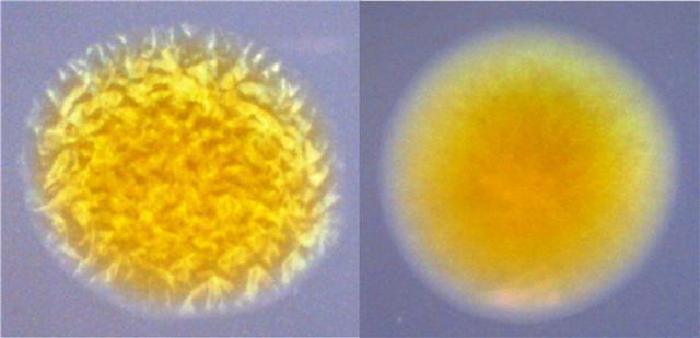 8 levittäytyneet reunat (Cipriano, R. C., Holt R. A. (2005)). Mikroskoopilla tarkasteltaessa pesäkkeestä voidaan havaita sekä marmoroitua että sileää kantaa (Kuva 2.) Kuva 2. F.