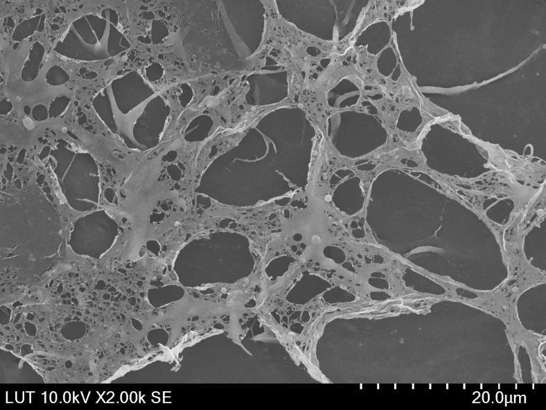 35 Kuva 18. SEM-kuva DES-6-menetelmällä valmistetusta nanoselluloosasta. Kuvassa verkkomaista nanoselluloosaa.