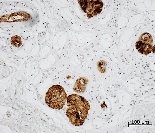 12 4.2 PIENET SYLKIRAUHASET Suuontelossa on 600-1000 pientä sylkirauhasta, jotka ovat halkaisijaltaan 1-5 mm. Suurin osa niistä sijaitsee huulessa, kielessä, posken limakalvoilla ja suulaessa.