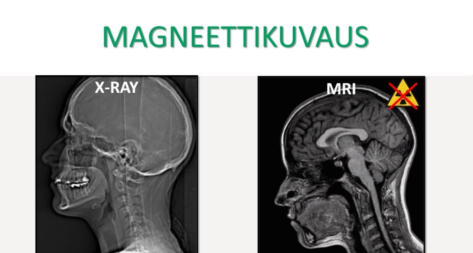 13 Lopullinen tuotos koostuu yhteensä 11 diasta, joissa kerrotaan magneettikuvauksen perusteista, magneettikentistä ja niiden turvallisuudesta, esineiden magneettiturvallisuudesta,