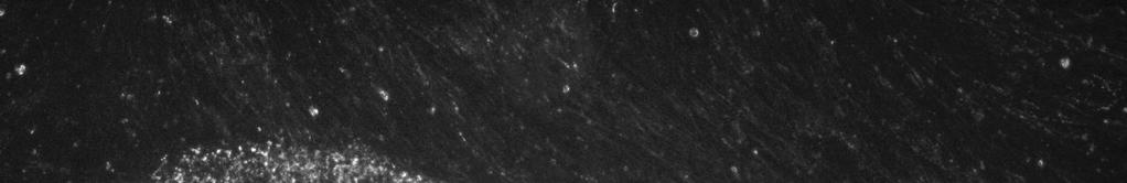hpscs Erilaistus RPE Retinan