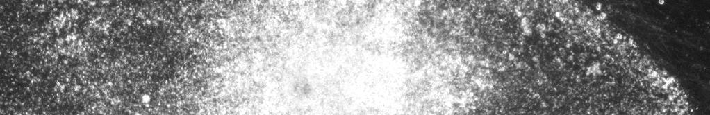 epilepsian hoito rappeutunut