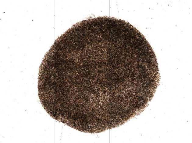 Ensimmäinen ihmiseen transplantoitu ips-soluista erilaistettu solumassa https://www.nature.
