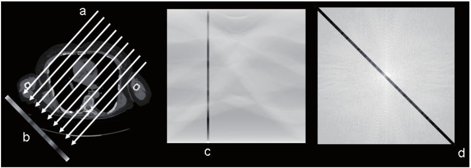 23 Kuvassa 1 on kuvattu, kuinka kuvantamisesta saaduista projektiokuvista muodostetaan sinogrammikuva ja siitä edelleen Fourier-muunnoksella saatu kuva.