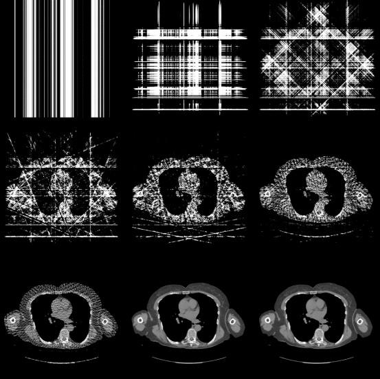 24 Kuva 3. TT-kuvan muodostus suodatettujen takaisinprojektioiden avulla, kun projektioita eri kulmista on 1, 2, 4, 8, 16, 32, 64, 256 ja 1024.