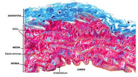 10 Figure 4. The cross-section of mouse aorta to demonstrate the arterial anatomy.