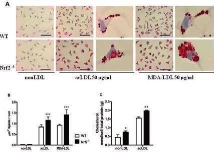 38 cytokine mrna expression in response to modified LDL, indicating more a M1-like macrophage phenotype (Figure 14E-H).