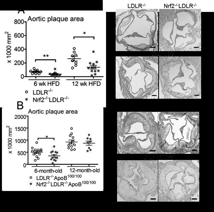 40 exhibited early atheromas/fatty streaks (type I-II), whereas in LDLR -/- mice lesions were more mature, containing small necrotic areas including cholesterol crystals (type II-III) (Figure 15A)