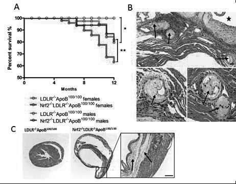 We found that Nrf2 deficiency reduced the size of atheroma plaques in LDLR -/- ApoB 100/100 female mice at 6 months of age in the aortic root, and after 12 months, in the descending aortas (Figure