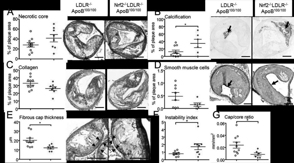 43 Nrf2 -/- LDLR -/- ApoB 100/100 and LDLR -/- ApoB 100/100 mice.