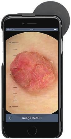 lisätiedoilla. Kuvia on myös mahdollista lähettää esimerkiksi sähköpostilla konsultaatioon. Laite toimii Apple iphone 5S/SE/6/6S/7/8 tai ipod touch 6.