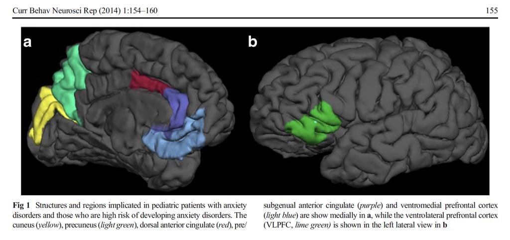 Strawn JR et al, Neurobiology of Pediatric Anxiety Disorders Precuneus Dorsal anterior