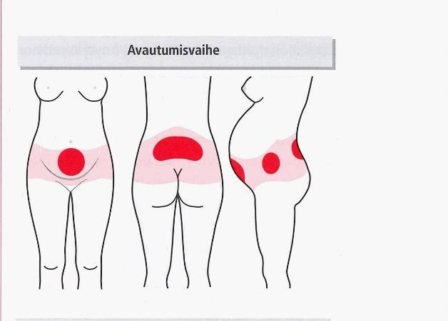 4.1.1 Avautumisvaiheen kipu 15 KUVA 1. Synnytyskivun sijainti synnytyksen eri vaiheissa (Raussi-Lehto 2015, 257) Avautumisvaiheessa synnytyskipu on lievimmillään supistusten ollessa vielä heikkoja.