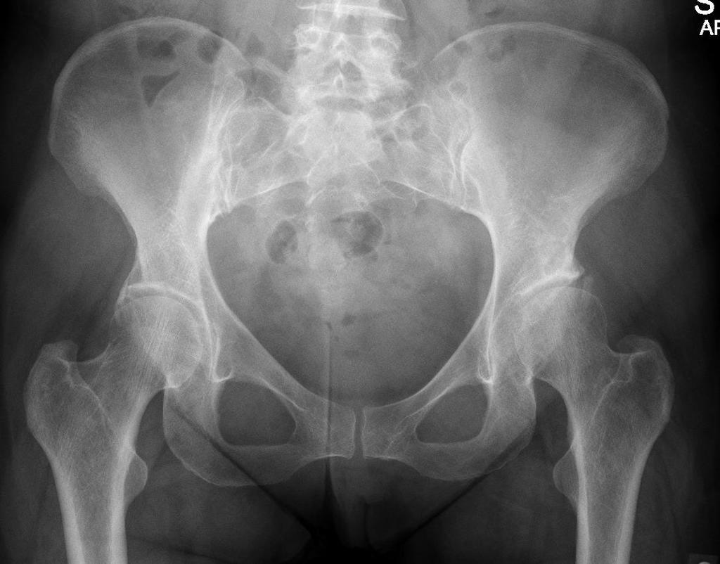 Diagnostinen röntgenkuvaus