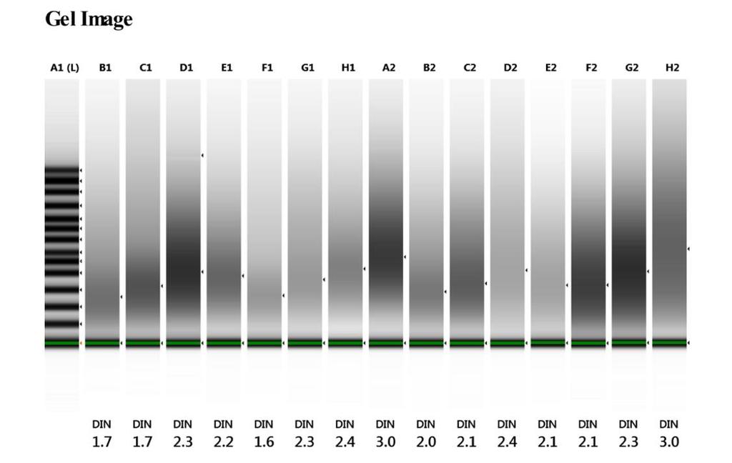 19 (49) tuumorinäytteistä eristetyn DNA:n DIN-arvot korreloivat NGS-parametrien kanssa.