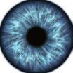 Äkillinen allerginen silmätulehdus eli allerginen konjunktiviitti on yleisin 1 silmissä
