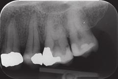 Tunne materiaalisi In circumstances where the fees are controlled by a third party, the profitability can be less for composite restorations