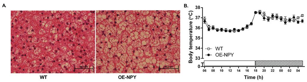 Results and Discussion 57 5.3.4 BAT and thermogenesis (study II) Homozygous OE-NPYDβH mice had increased BAT weight already at the age of 2 months (males: WT 81.4±6.41 mg, OE-NPYDβH 122.0±10.