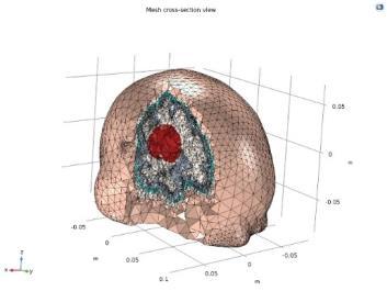 Electrical impedance tomography (EIT) - a novel imaging method to improve