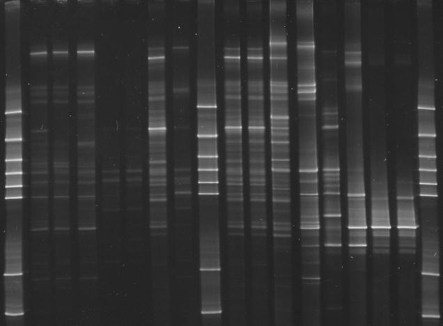 Chin Rection (PCR) with primers pir