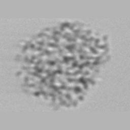 Oocystis acuminata