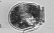 8 Centrales Chroococcales Dinophysis Dolichospermum Oocystis acuminata Anabaenopsis Figure 1.