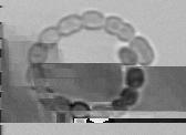 In the feature extraction step of a computer vision system, predefined image features are extracted from
