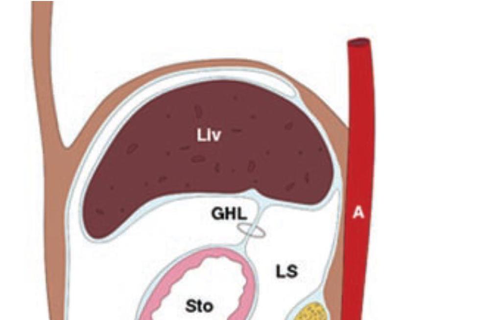 Dorsal mesogastrium continues to grow inferiorly and fuses