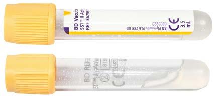 BD Vacutainer SST II Advance -seerumigeeliputki BD SST II Advance -putkissa on lisäaineena hyytymisaktivaattori, joka aktivoi näytteen hyytymisen ja geeliä, joka erottaa hyytymän ja seerumin