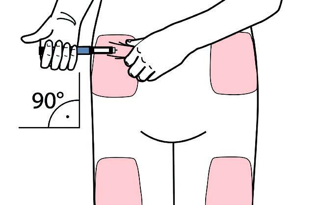 Huomautus: Jos sylinteriampullissa on alle 80 mikrolitraa jäljellä, annostelunuppia ei voi kääntää myötäpäivään nuolimerkille.