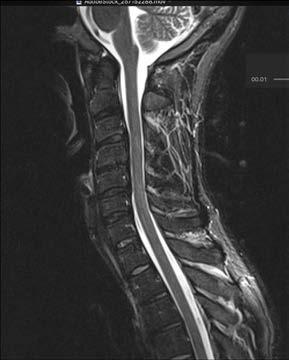 kuvantaminen MS-tauti, enkefaliitti, epilepsia (esim.